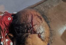 Photo of गौशाला में बहूभोज में हुई मारपीट के मामले में 11 लोगों के विरुद्ध शिकायत दर्ज