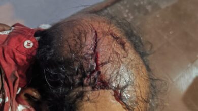 Photo of गौशाला में बहूभोज में हुई मारपीट के मामले में 11 लोगों के विरुद्ध शिकायत दर्ज